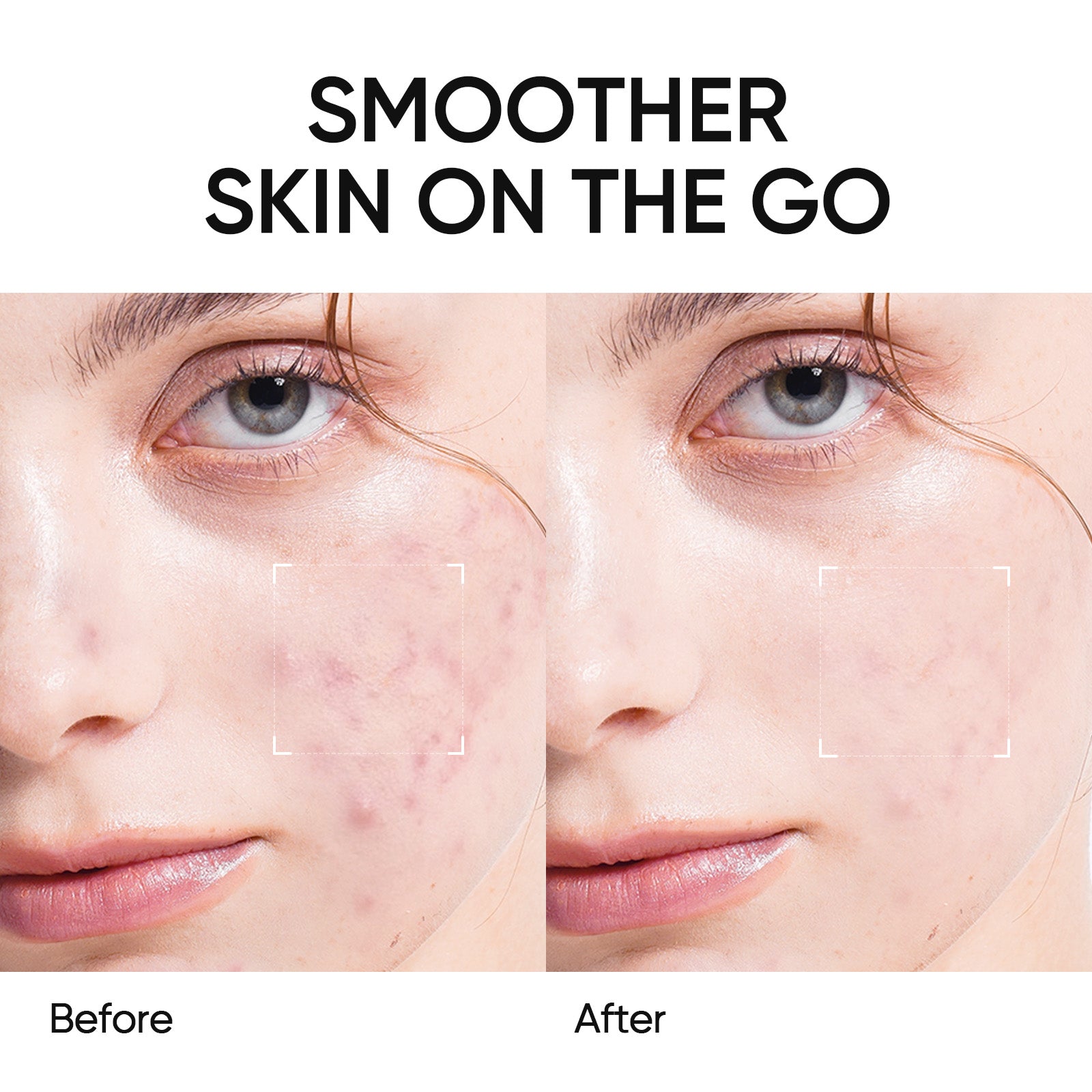Toallitas exfoliantes AHA, BHA y PHA
