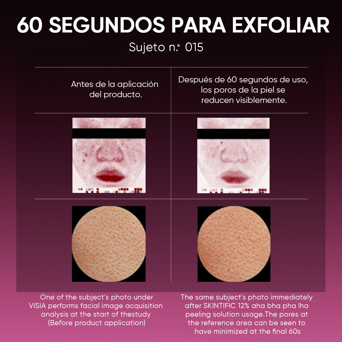 Sérum Exfoliante con 12% AHA, BHA, PHA y LHA
