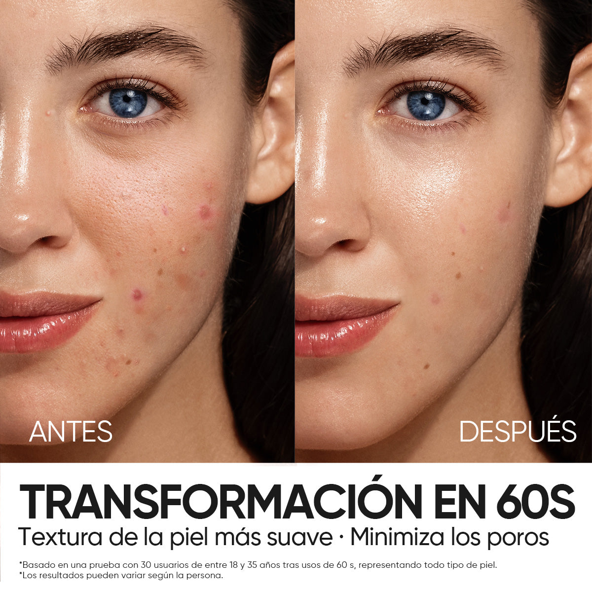 Sérum Exfoliante con 12% AHA, BHA, PHA y LHA