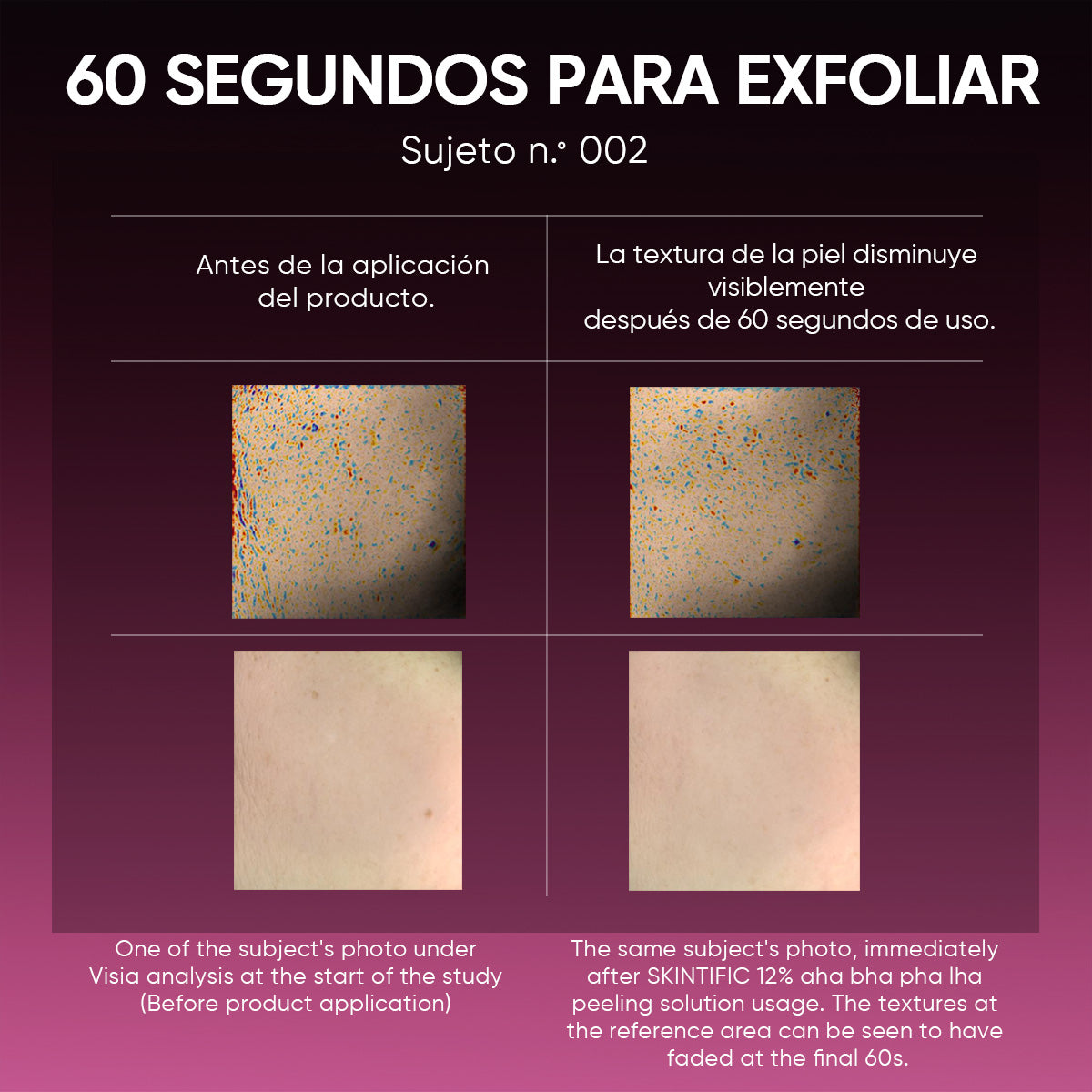 Sérum Exfoliante con 12% AHA, BHA, PHA y LHA