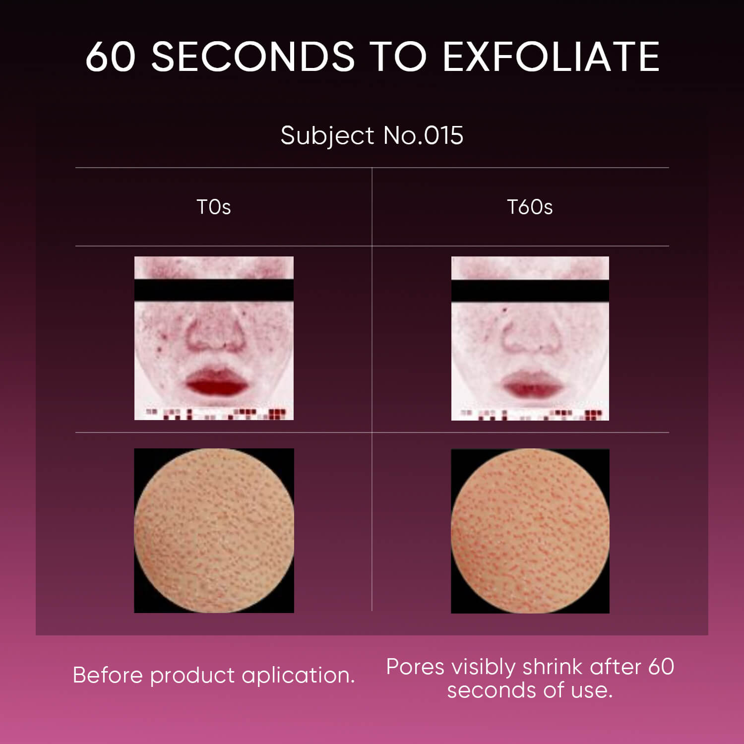 Sérum Exfoliante con 12% AHA, BHA, PHA y LHA