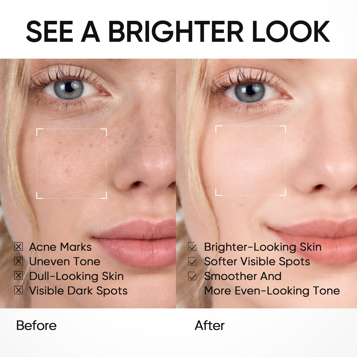 Niacinamide Brightening Serum & Moisture Gel Set