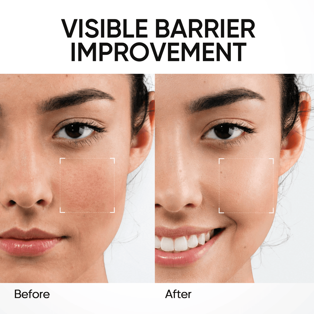 Gel Hidratante Reparador de la Barrera con 5X Ceramidas