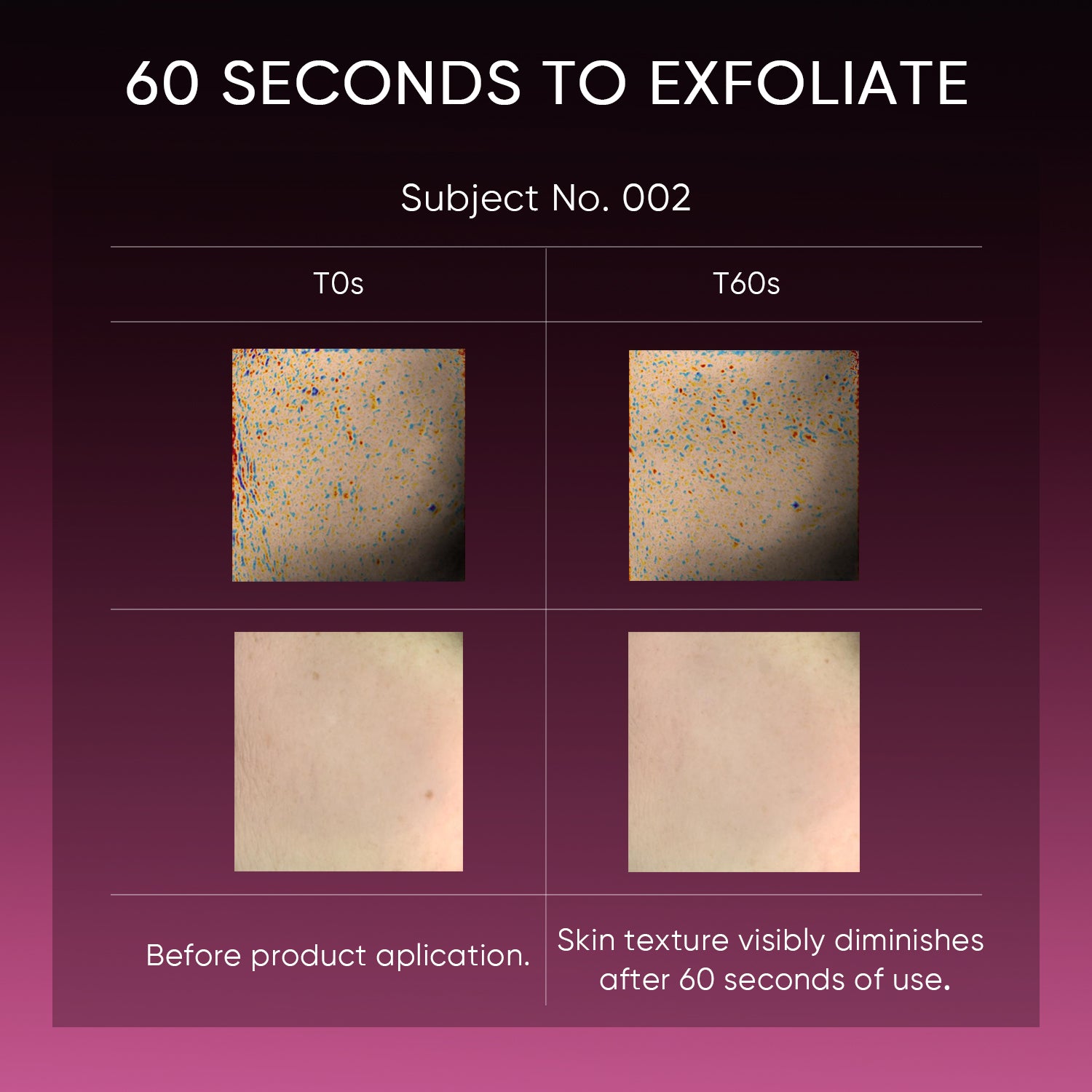Sérum Exfoliante con 12% AHA, BHA, PHA y LHA
