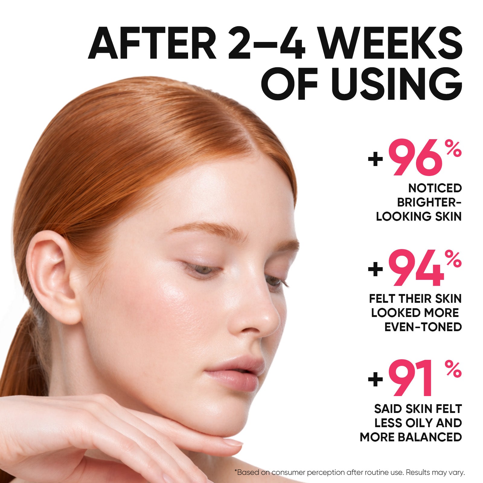 Set Iluminador MSH Niacinamide – 4 piezas