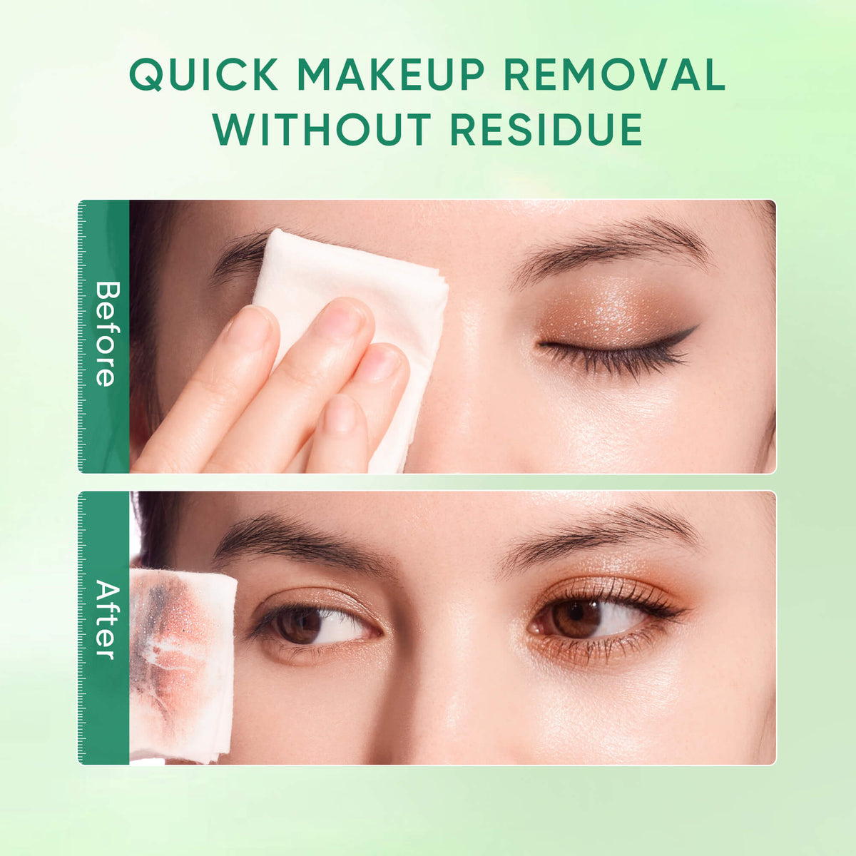 Centella Acne Care Micellar Cleansing Wipes for Acne-Prone Skin
