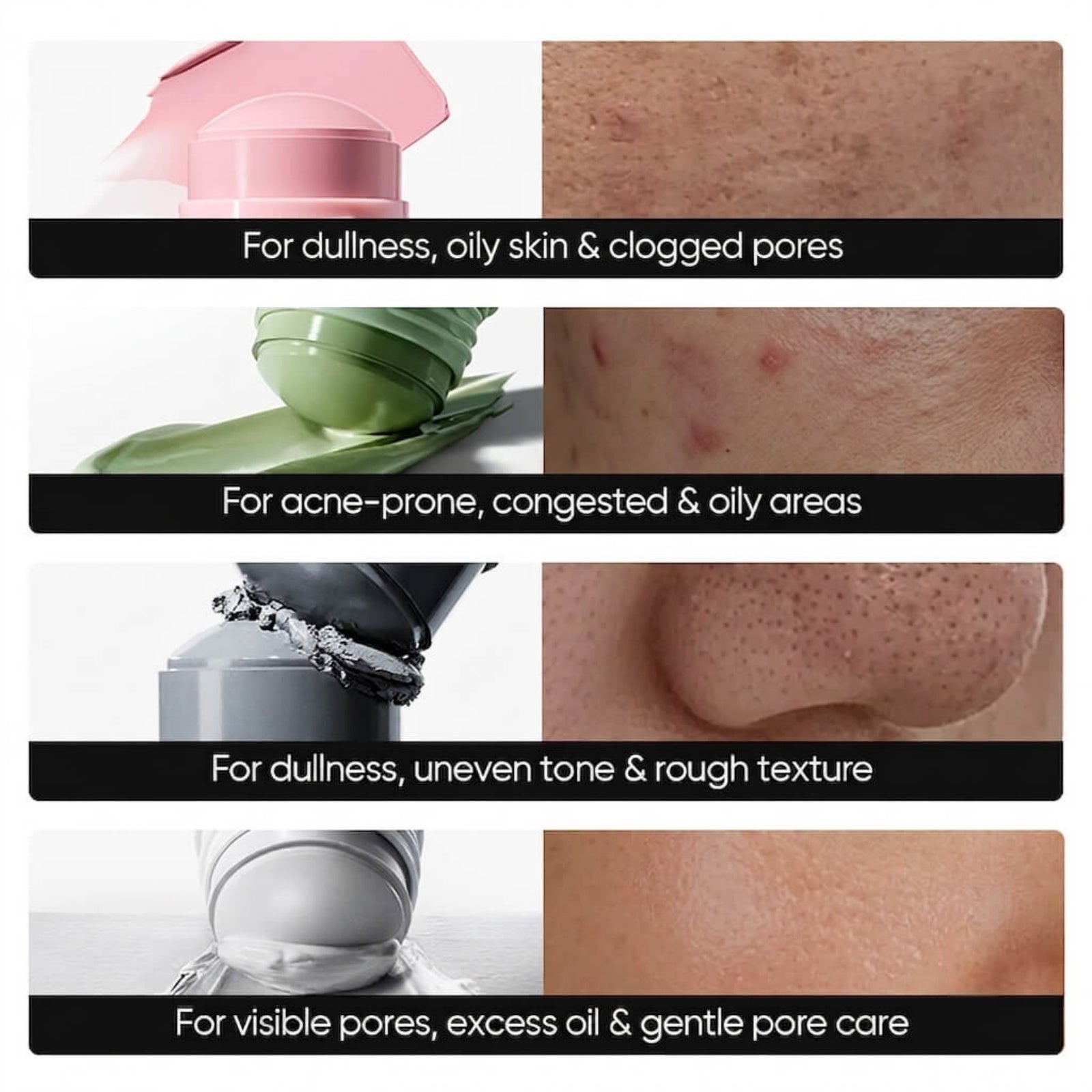 Deep Cleansing Clay Mask Set for Blackheads, Acne & Pore Care